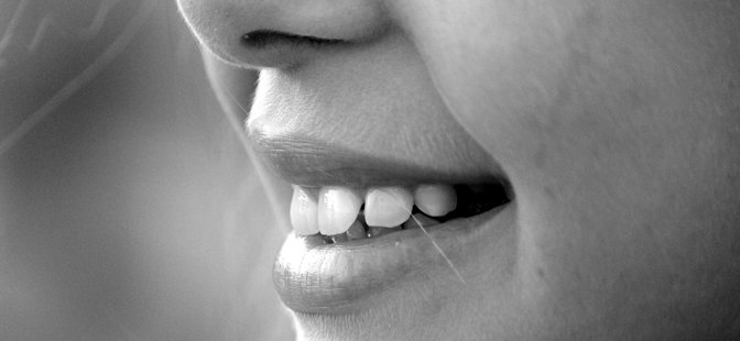 Purentalihakset kuntoon - Purentalihasten manuaalista käsittely- ja rentoutusosaamista suuhygienisteille